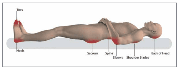 Pressure injury prevention map 13