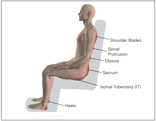 Pressure injury prevention map