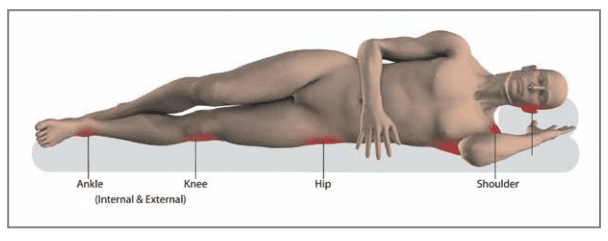 Pressure injury prevention map 4